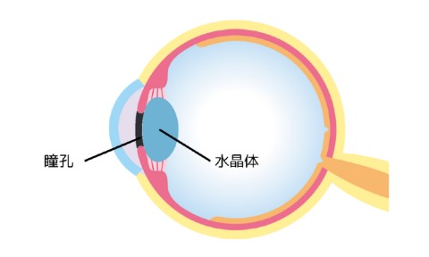 眼の構造 白濁した水晶体と瞳孔